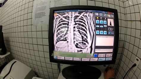 Slot De Digitalizacao De Radiografias